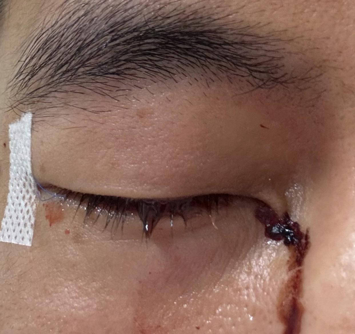 球员虐待事件引发公愤，体育界道歉