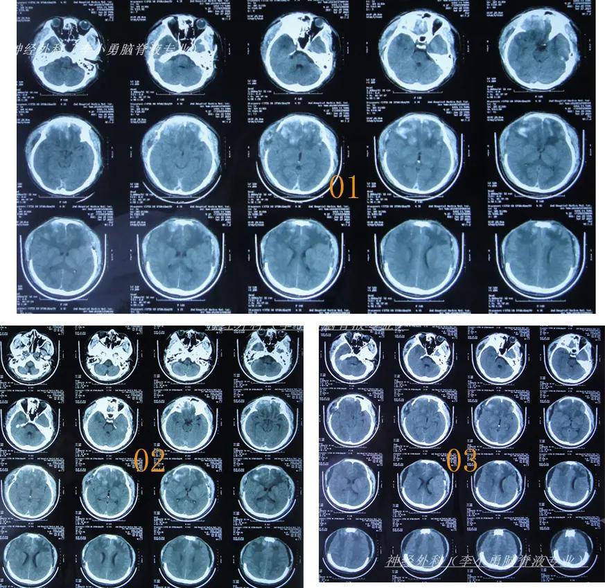 坡城遭险与利,比擦场战绩额皮 坡城遭险与利,比擦场战绩额皮