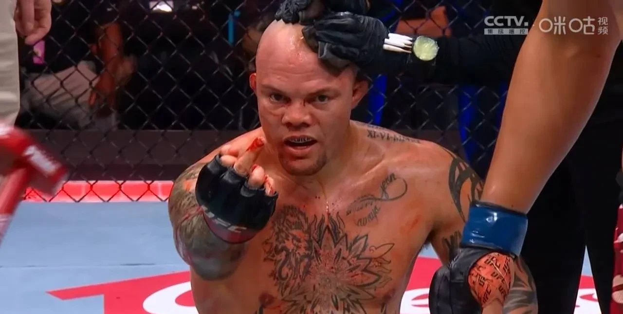 DB game-多米尼加选手弗兰多擒获人名拳击男子冠军的简单介绍